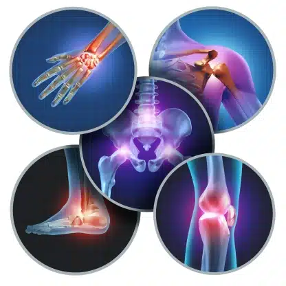 The Hidden Dangers of Chronic Inflammation Causes, Symptoms, and Solutions